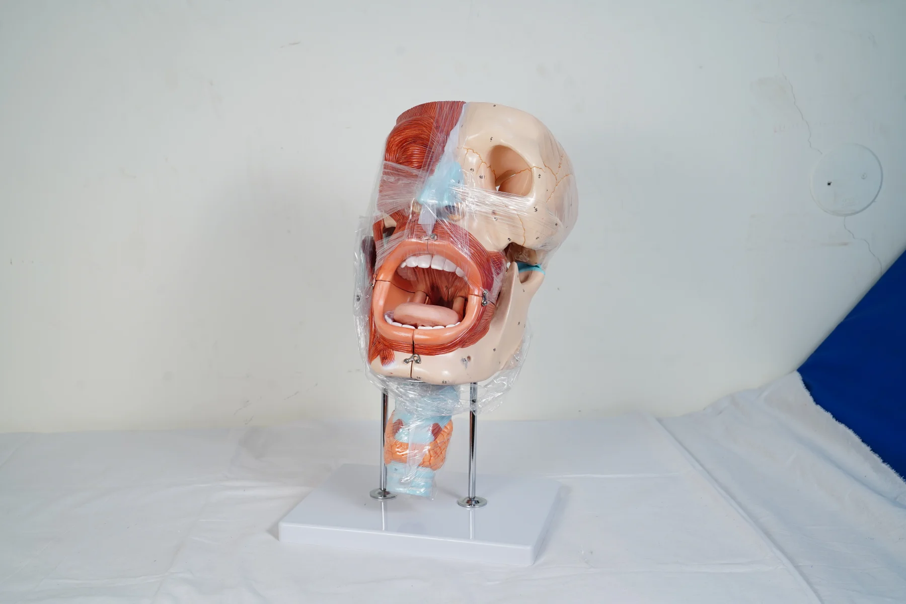 Cavities of Nose Mouth Throat Enlarged thumbnail 6