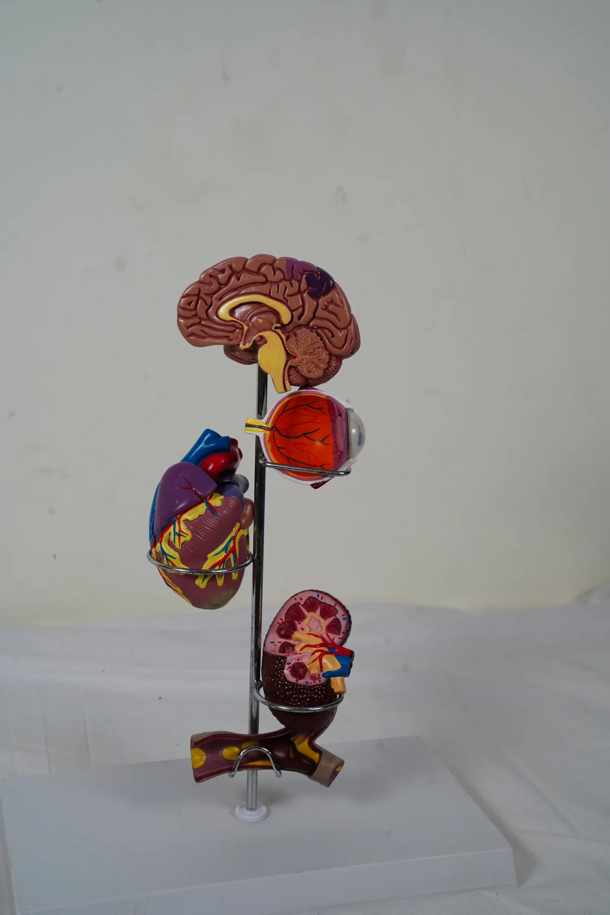 Hypertension Affected Organs Model thumbnail 5