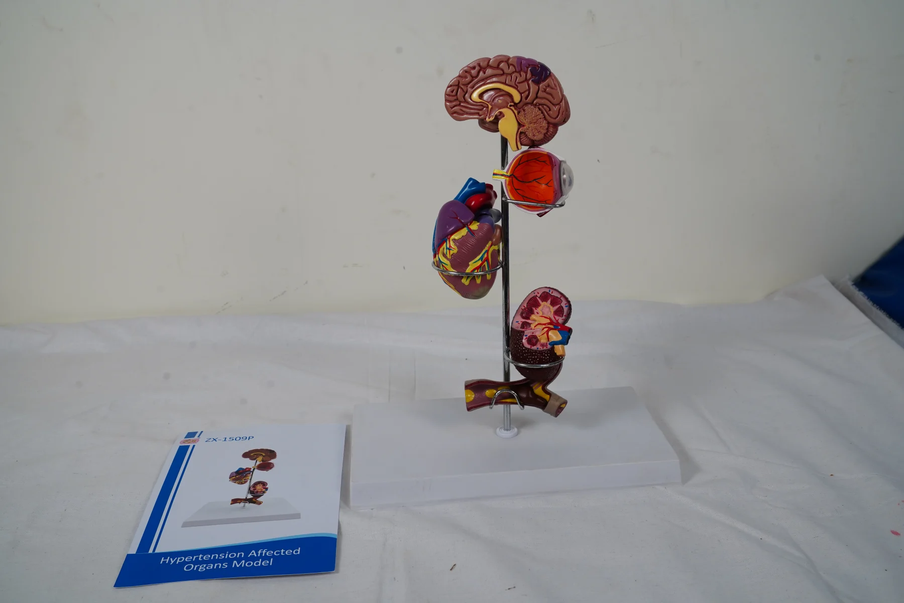 Hypertension Affected Organs Model