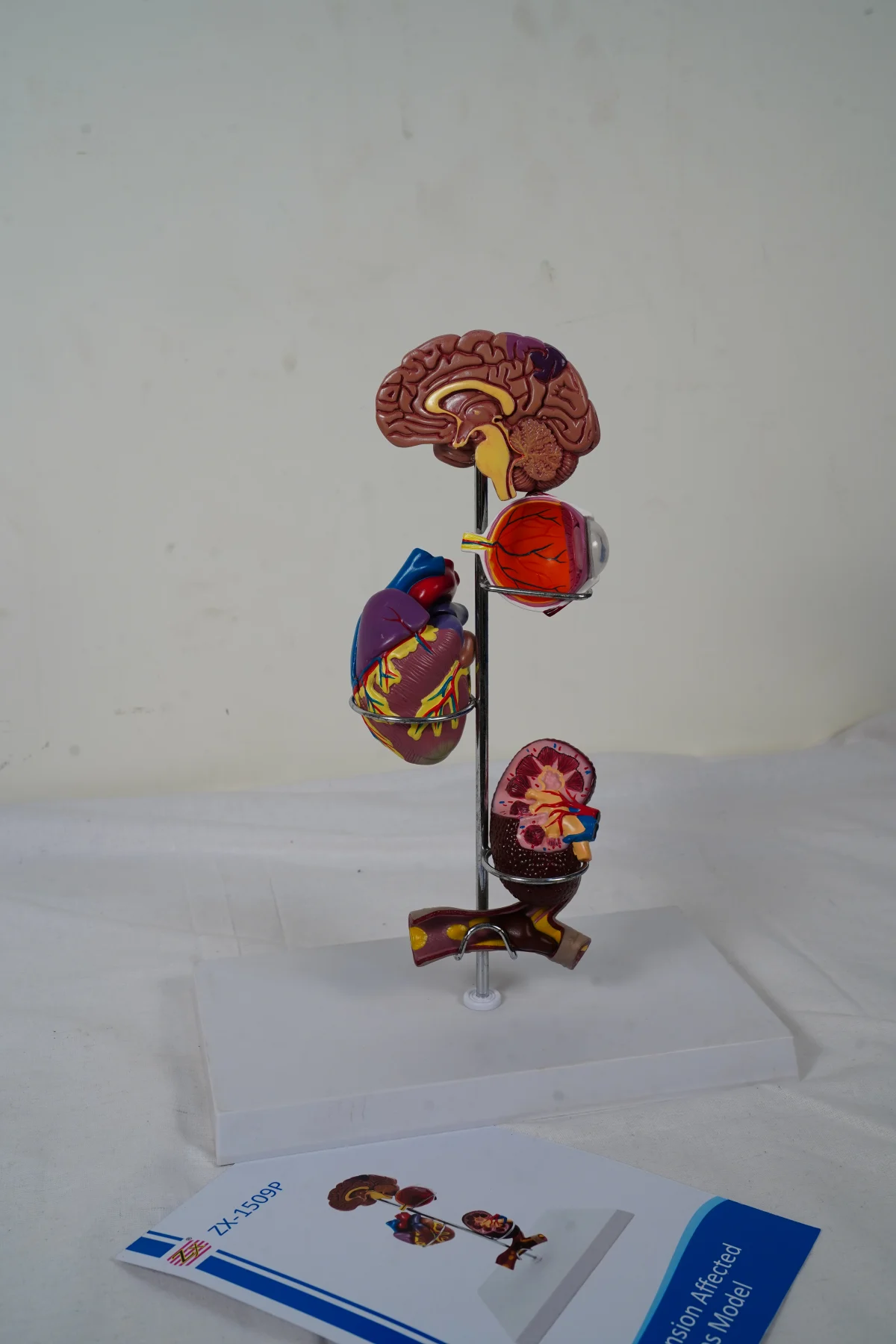 Hypertension Affected Organs Model thumbnail 3