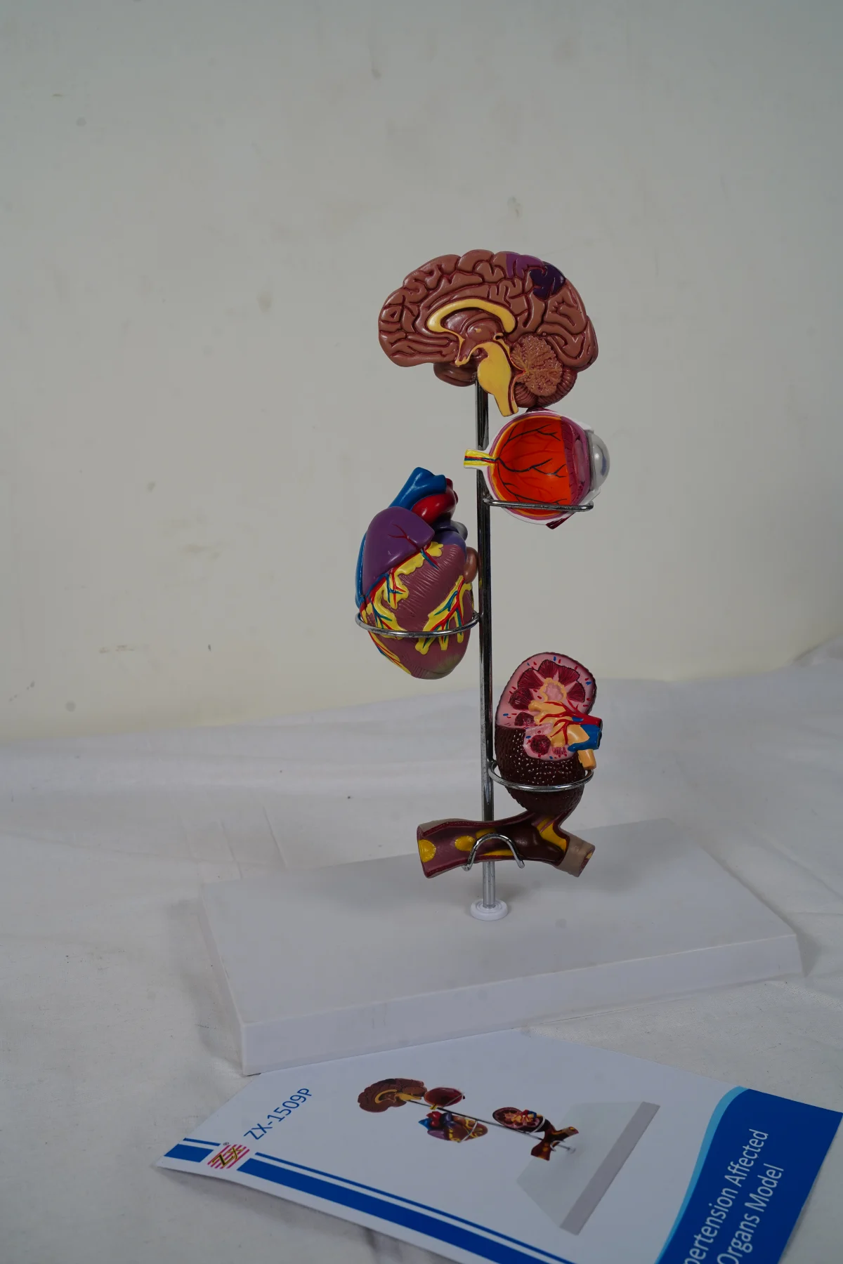 Hypertension Affected Organs Model thumbnail 4